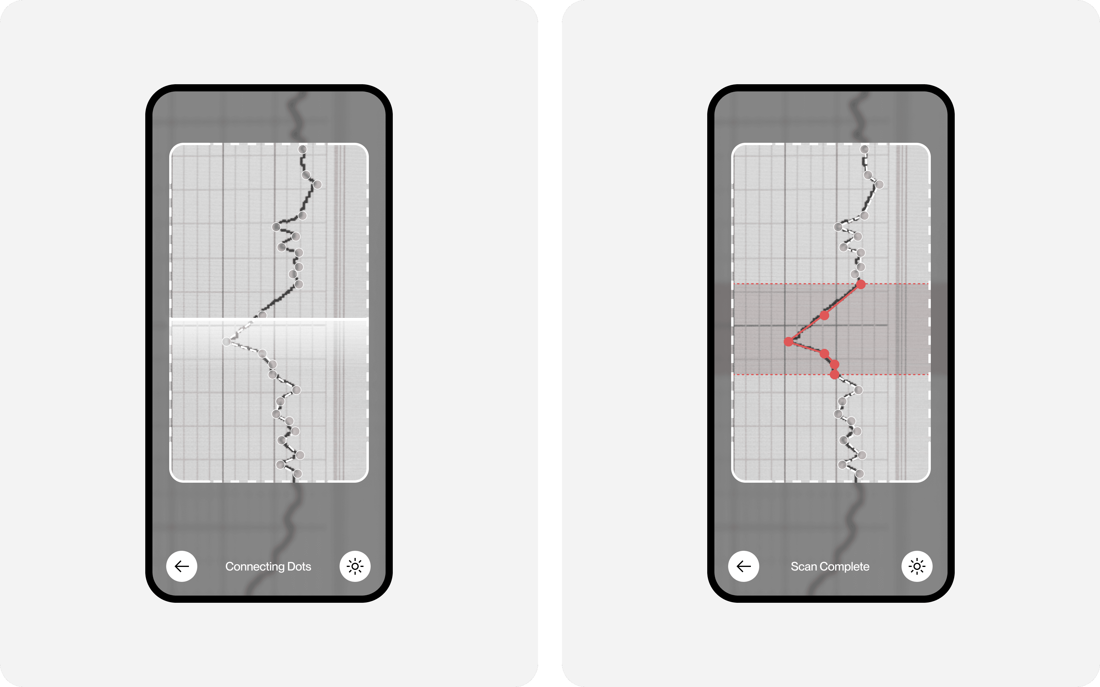 Zwei Smartphone-Screens einer CTG-Analyse-App: links Scan mit Overlay „Connecting Dots“, rechts vollständige Kurvennachzeichnung mit „Scan Complete“.