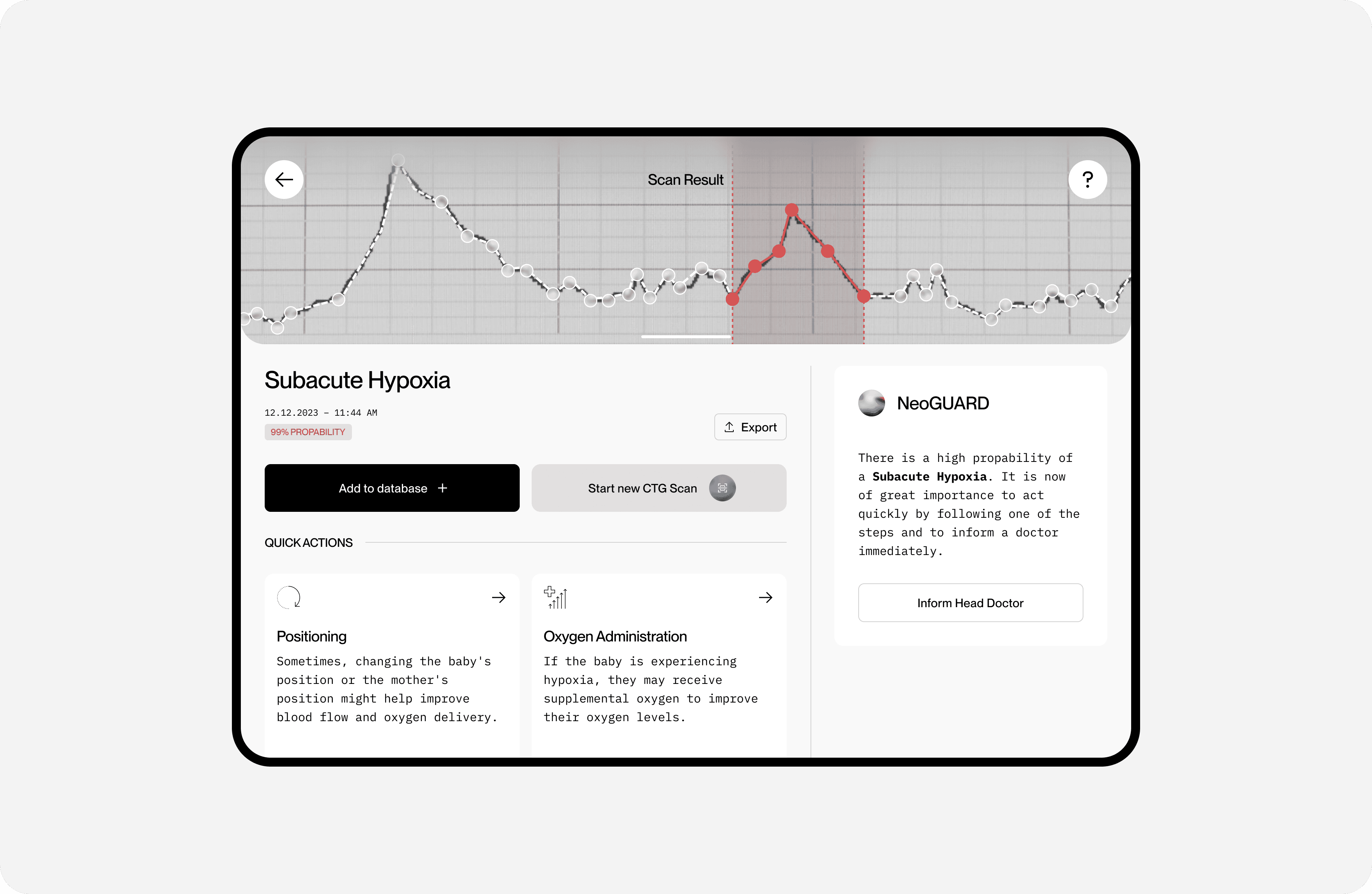 Tablet mit medizinischer Fetalmonitoring-App, zeigt Scan-Ergebnis mit markierter Auffälligkeit, Diagnose „Subacute Hypoxia“ und empfohlenen Schnellaktionen.